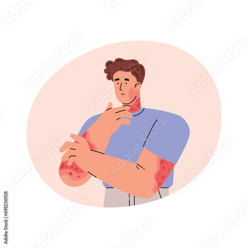 Man with skin problem on hands. Vector illustration in flat style.