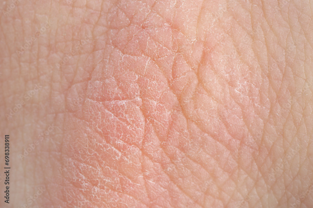 Texture of healthy skin as background, macro view Texture of healthy skin as background, macro view