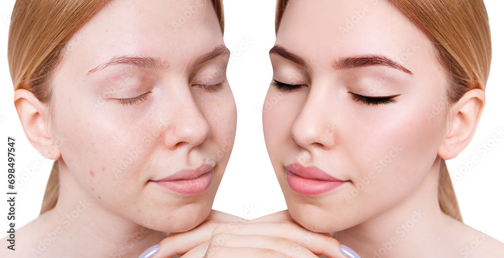 Young woman before and after make-up. Young woman before and after make-up.