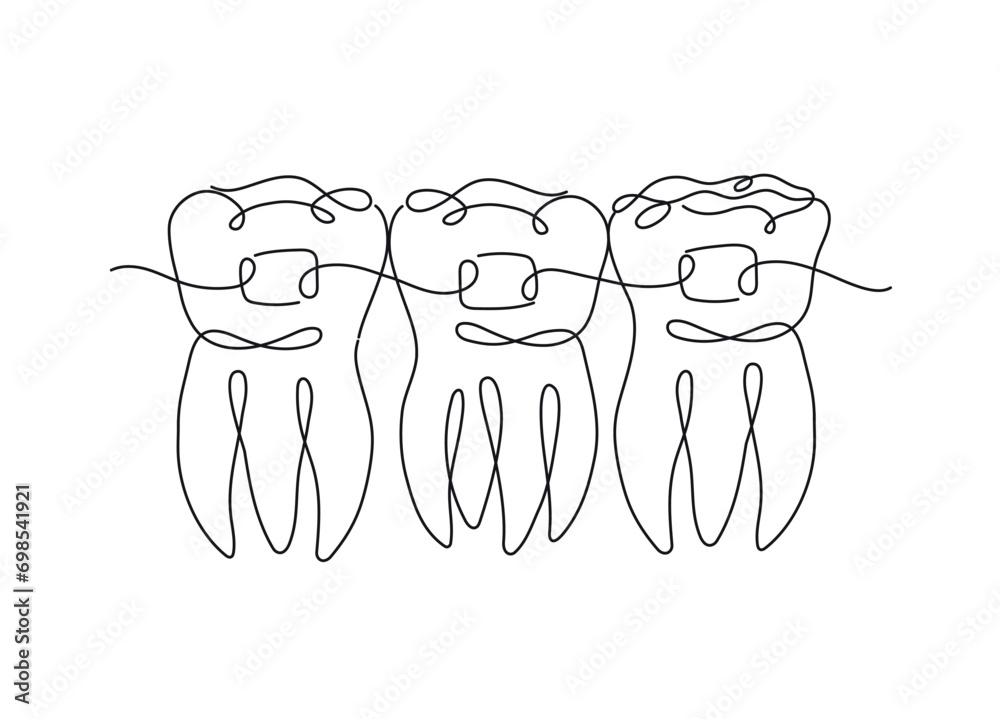 Teeth with braces illustration drawing in flat line style on white background