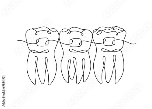 Obraz na płótnie Teeth with braces illustration drawing in flat line style on white background w salonie