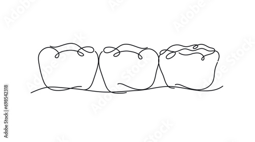 Obraz na płótnie Implanted teeth with crown bridge illustration drawing in flat line style on white background w salonie