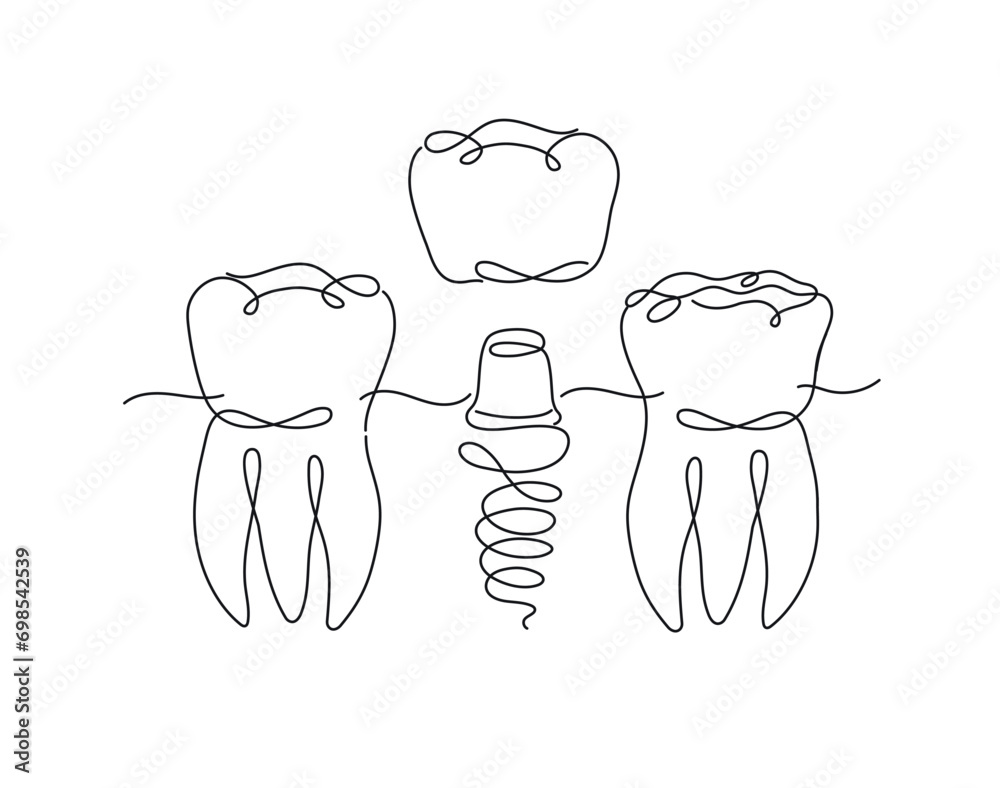 Teeth implant illustration drawing in flat line style on white background