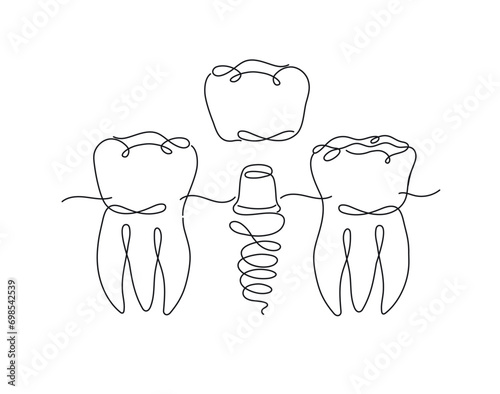 Obraz na płótnie Teeth implant illustration drawing in flat line style on white background w salonie