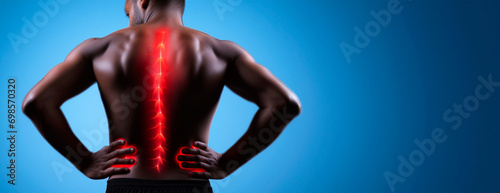 Muscular man standing turned and experiencing back pain in the form of redness on a dark background. Sports injury. Rehabilitation. Remedy ointment against pain. Spinal problems. Back exercises photo