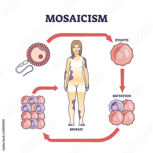 Mosaicism as medical genetic condition with cellular sets defect outline diagram, transparent background. Labeled educational scheme.
