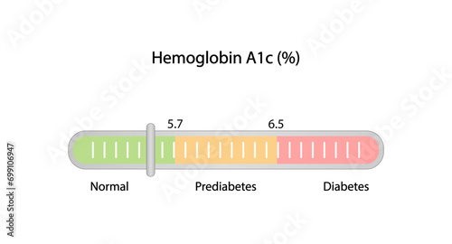 Hemoglobin A1C, HbA1c test results, glycated hemoglobin, A1C Blood Sugar Test, Diabetes Mellitus. Vector illustration.	