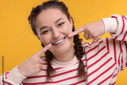 Happy woman pointing at braces on her teeth against orange background
