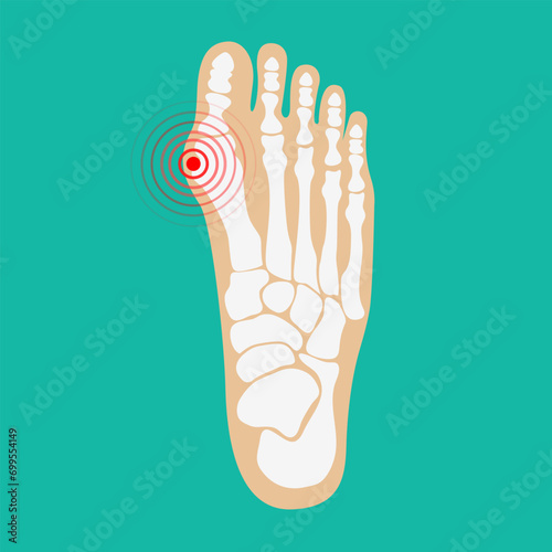 Human leg pain zones. Design elements for infographic. Vector illustration.
