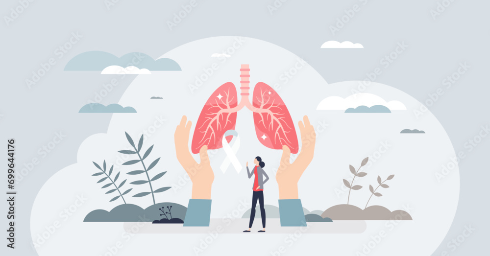 Tuberculosis awareness or TB lung bacterial infection tiny person concept. Respiratory illness with medical pathology vector illustration. Bronchitis, asthma, cancer or bronchial health condition. - obrazy, fototapety, plakaty 