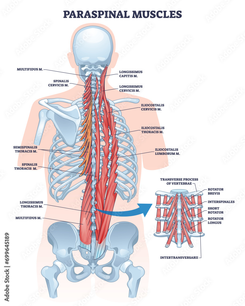 Paraspinal muscles as erector spinae or back muscular system outline