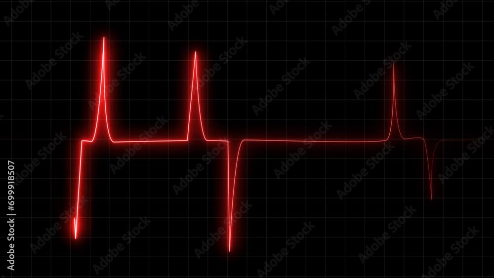 Red color heartbeat animation Red color heartbeat animation