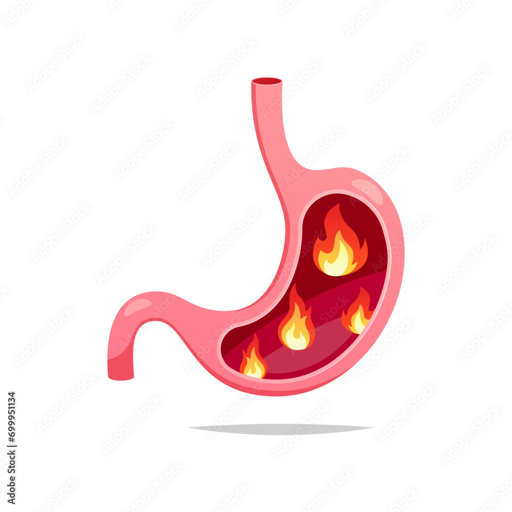 Flame in human stomach vector isolated on white background. Flame in human stomach vector isolated on white background.