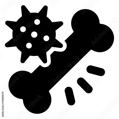 bone cancer
