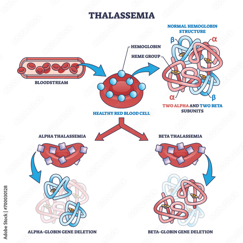 thalassemia-blood-disease-as-hemoglobin-structure-deletion-outline-diagram-labeled-educational