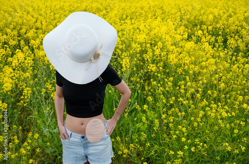 Portrait of a woman with a sun hat and colostomy bag in yellow flowers field. Oncology awareness photo
