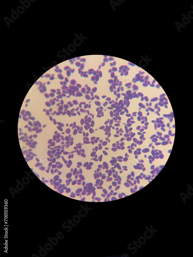 A smear of yeasts Wickerhamomyces anomalus under a microscope is stained with gentian violet or Gram photo