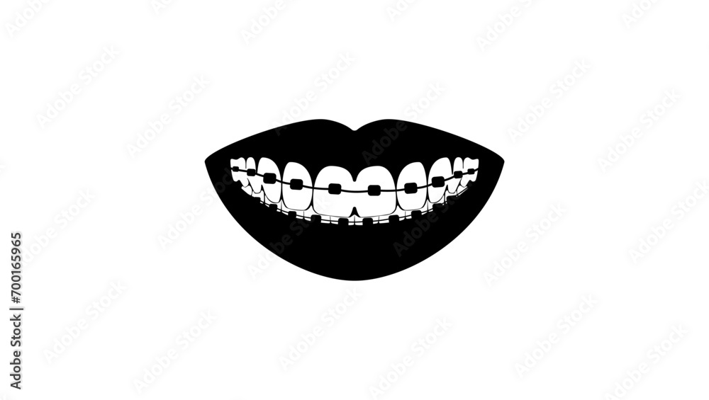 Briquettes on teeth, black isolated silhouette Briquettes on teeth, black isolated silhouette