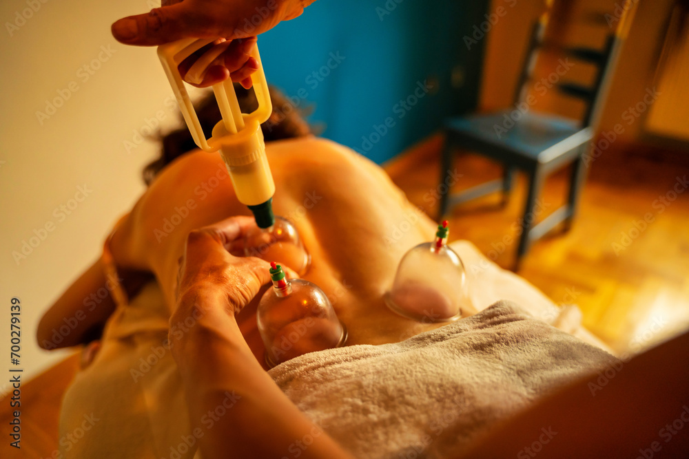 Usage of acupuncture points in a modern clinic. Woman receiving cupping treatment on back by therapist, chinese medicine treatment, health and healing concept.