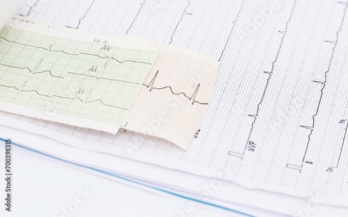 heart rhythm ekg note on paper Doctors use it to analyze heart disease treatments. illustration on a white background