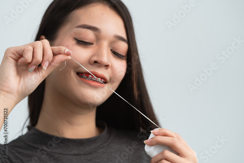 Asian woman braces using dental floss. Teeth braces on the white teeth of women to equalize the teeth. Bracket system in smiling mouth, close up photo teeth, macro shot, dentist health concept. photo