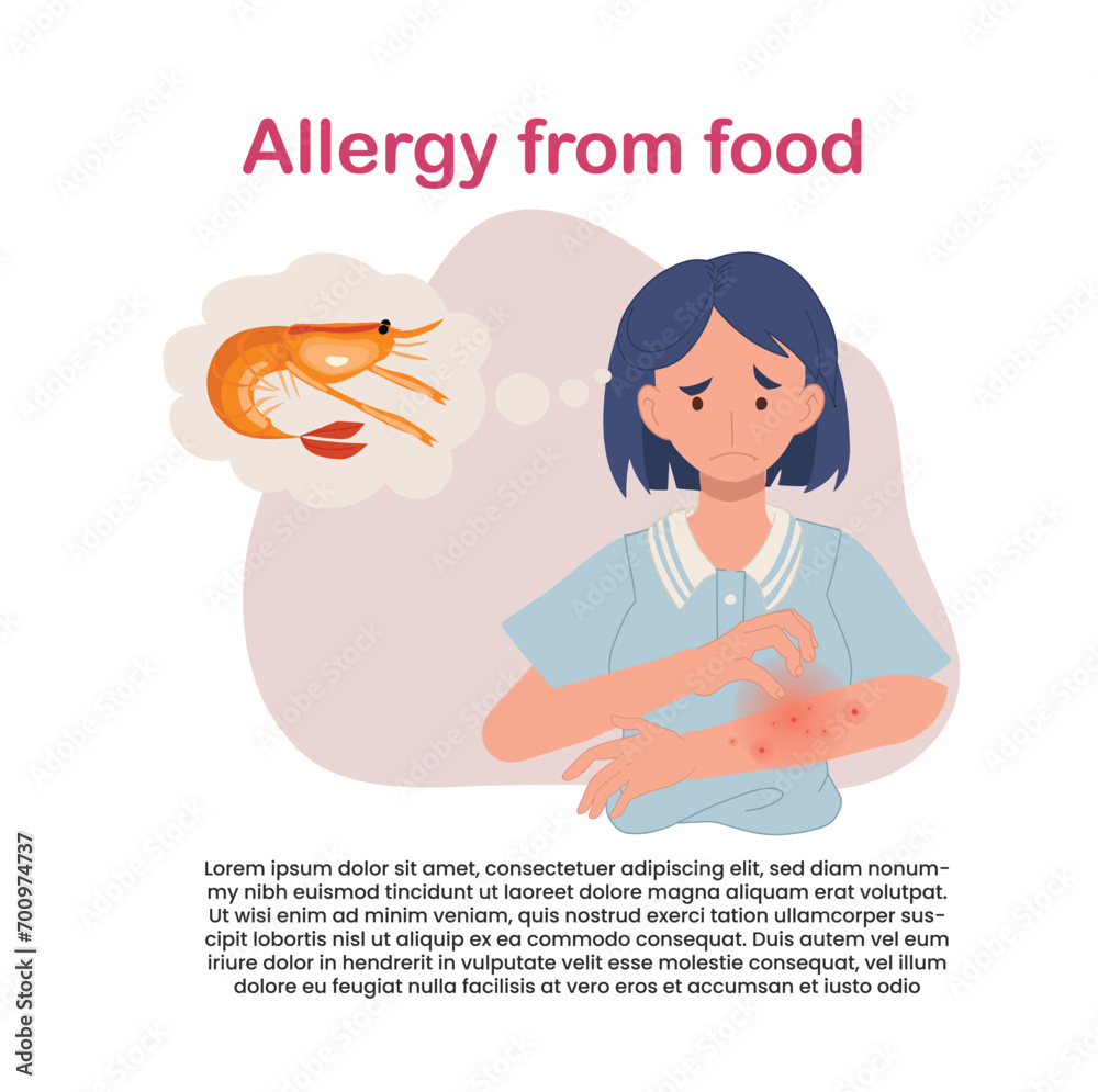 seafood Allergy Reaction. Woman with Itchy Red Rash on Arm. Allergic