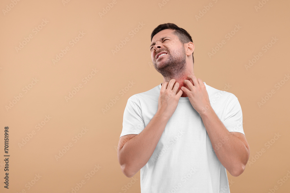 Allergy symptom. Man scratching his neck on light brown background. Space for text Allergy symptom. Man scratching his neck on light brown background. Space for text