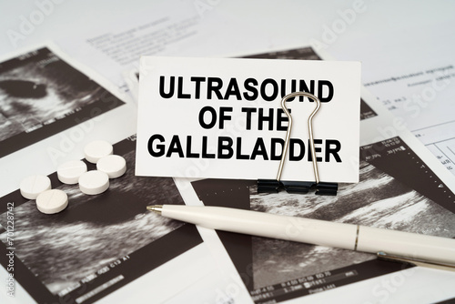 On the ultrasound pictures there is a pen and a business card with the inscription - Ultrasound of the gallbladder photo