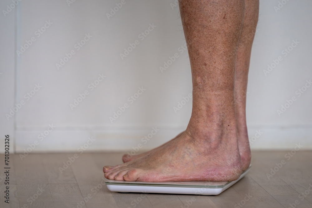 A man with dry winter feet weighs himself on a bathroom scale. A man with dry winter feet weighs himself on a bathroom scale.