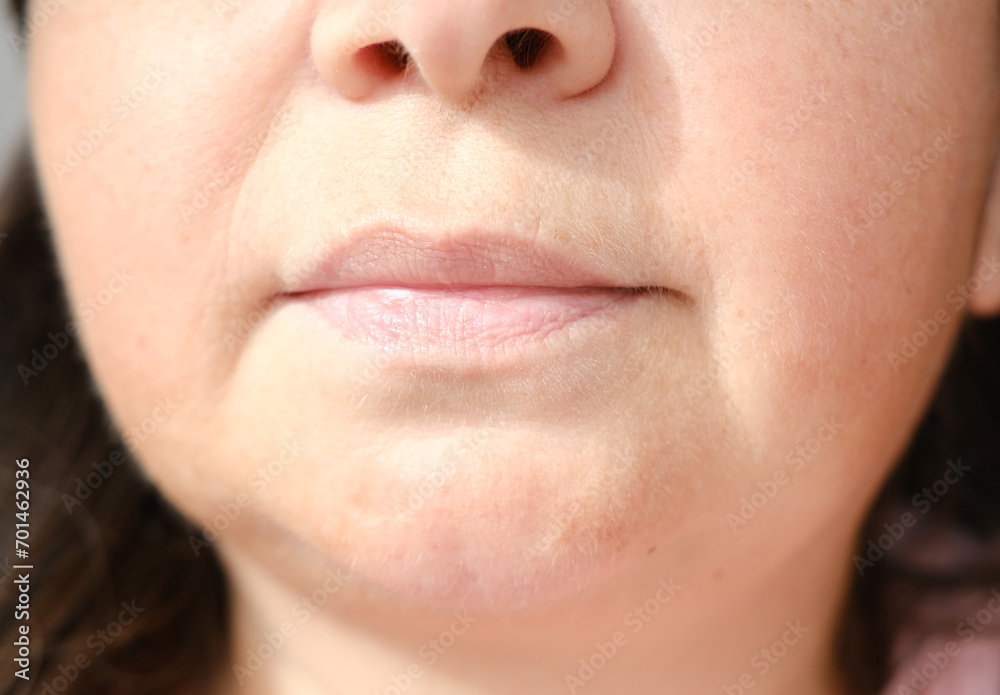 Obraz premium close up part face mature woman 55 years old, lower half of face, deep wrinkles around mouth, sagging cheeks, sagging cheeks, aesthetic injection cosmetology, correction surgery, antiaging procedures