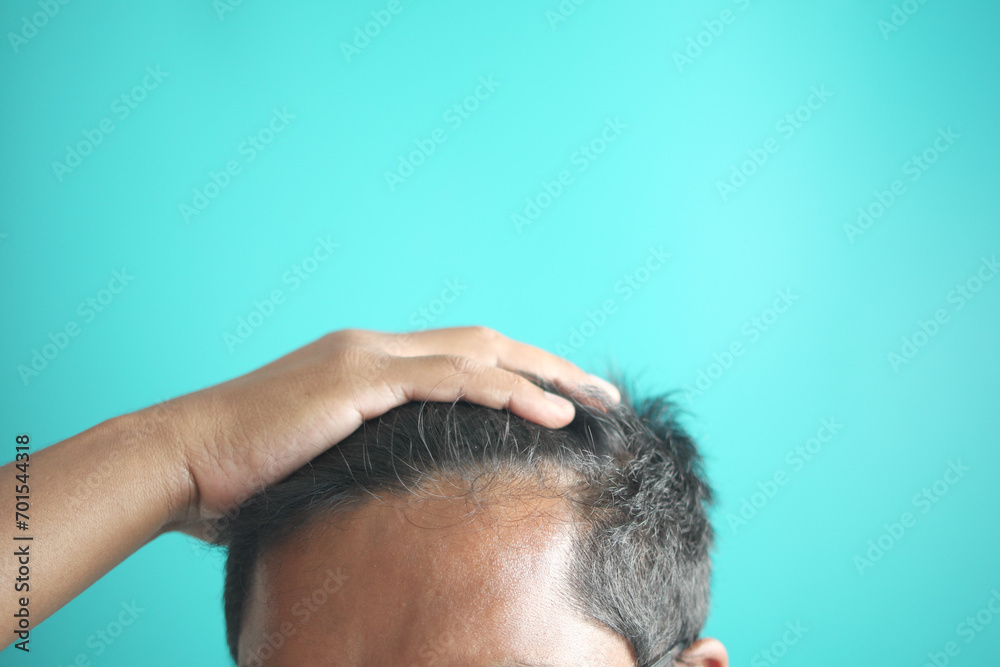 Fototapeta premium hair loss concept with man checking his hair 