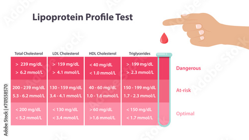 Lipoprotein cholesterol profile test vector illustration medical infographic