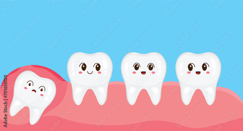 Wisdom teeth under the gums cause pain in the mouth. Toothache, gum pain. Vector illustration in cartoon style. Kawaii mascot collection. Healthy and diseased teeth. Oral health. Wisdom teeth under the gums cause pain in the mouth. Toothache, gum pain. Vector illustration in cartoon style. Kawaii mascot collection. Healthy and diseased teeth. Oral health.