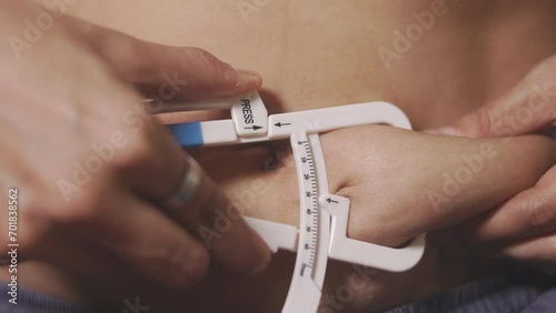 Close-up shot of the caliper measuring the oversized woman's skin fat for measuring body fat and weight from excess skin and cellulite around her stomach due to overeating and unhealthy lifestyle.  photo
