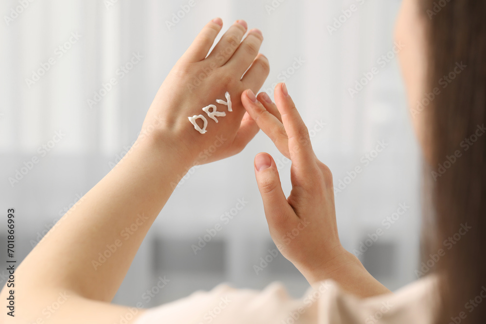 Young woman with word Dry made of cream on her hand indoors, closeup Young woman with word Dry made of cream on her hand indoors, closeup