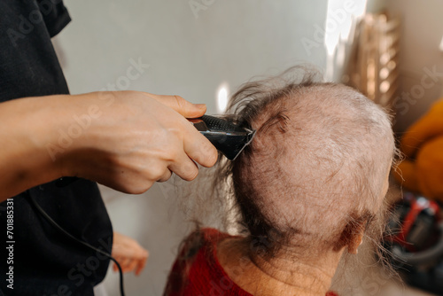 shaving woman because of a cancerous tumor. removal of hair on the head with an electric razor before surgery. hair loss due to cancer. shaving the grandmother's head before a course of chemo therapy photo