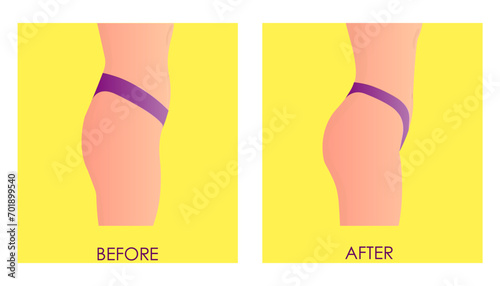 Vector illustration of weight loss. The girl stepped on floor scales before and after losing weight. Advertising of fitness, weight correction programs, hardware procedures for losing weight.