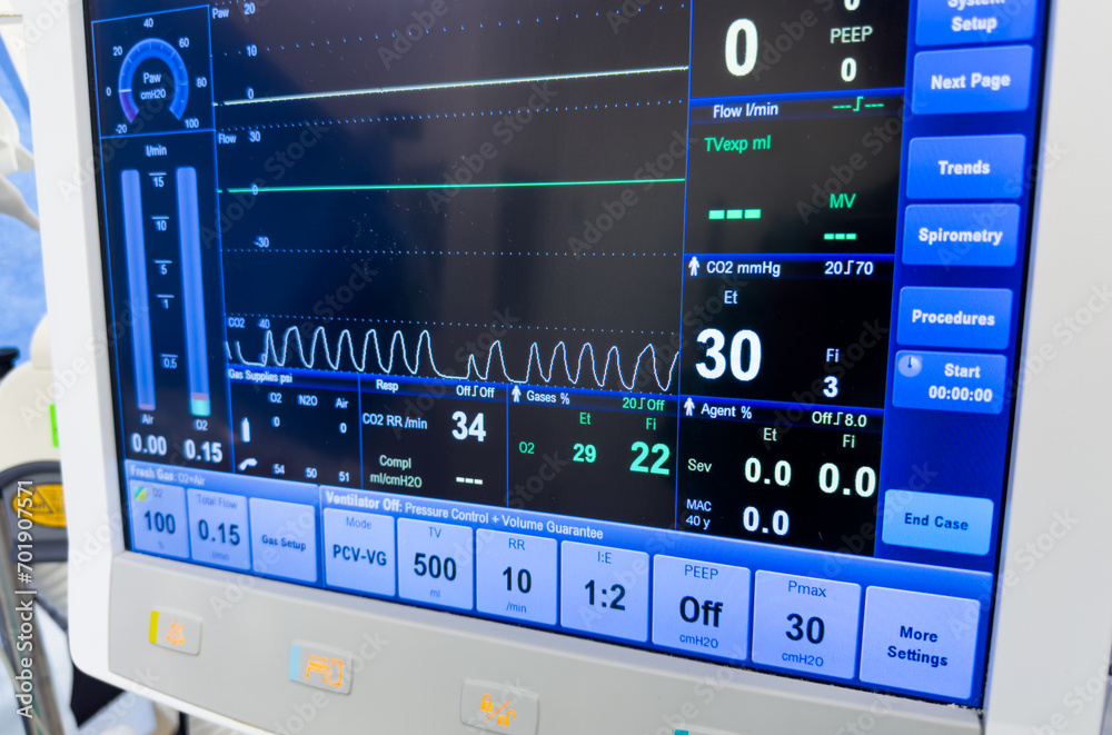 Hospital monitor displays vital signs, healthcare concept, medical equipment, patient health tracking