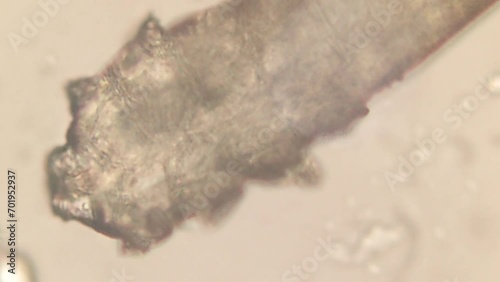 high resolution footage of face mite demodex under the microscope photo