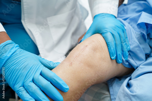 Doctor checking Asian elderly woman patient with scar knee replacement surgery in hospital.