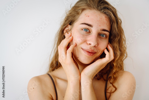 Close-up of a cute woman with problem skin looking in the mirror. A curly woman with rashes on her face is worried about the health of her skin. Dermatology concept  allergy.