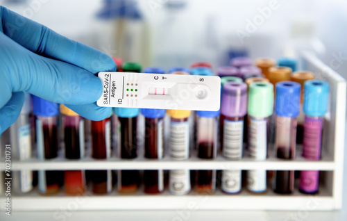 test Cassette for Covid-19 variant included Pirola BA.2.86. Blood tubes test in background. Antigen test kit for SARS‑CoV‑2 self testing  photo