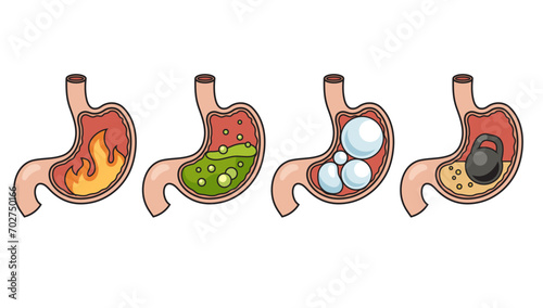 Stomach disease. Heaviness in the stomach, bloating, increased acidity in the stomach, burning in the stomach hand drawn schematic vector illustration. Medical science educational illustration