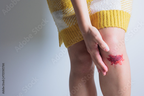 Foto 擦りむいた脚を抑える女性の手（ダーク）