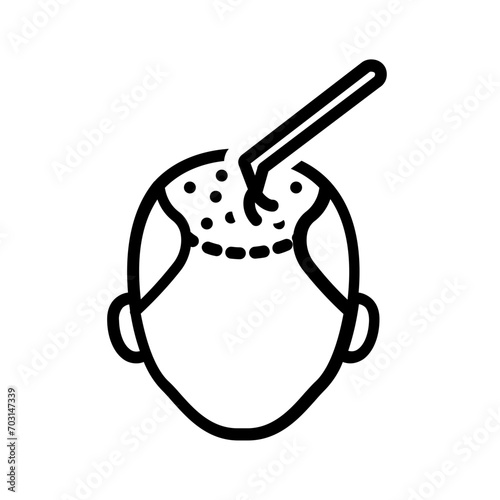 Black line icon for Hair transplant