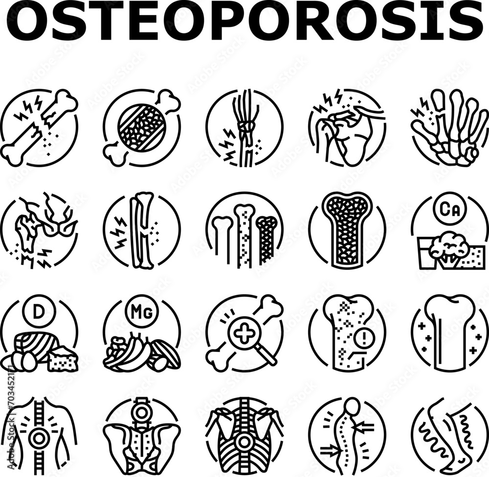 osteoporosis bone pain calcium icons set vector. health anatomy, spine doctor, knee woman, arthritis density, hip femur, structure osteoporosis bone pain calcium black contour illustrations