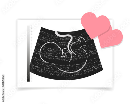 Ultrasound photograph of an unborn embryo and pink hearts. Illustration, postcard, vector