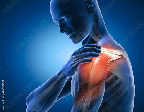 Painful shoulder joints. Frozen shoulder, Impingement. 3d illustration photo