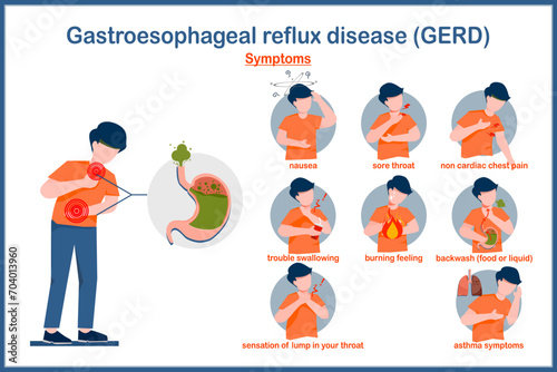 Medical vector illustration in flat style. Symptoms of Gastroesophageal reflux disease. Illustration of a human stomach filled with gas and a man in stomach and throat pain caused by acid reflux. photo