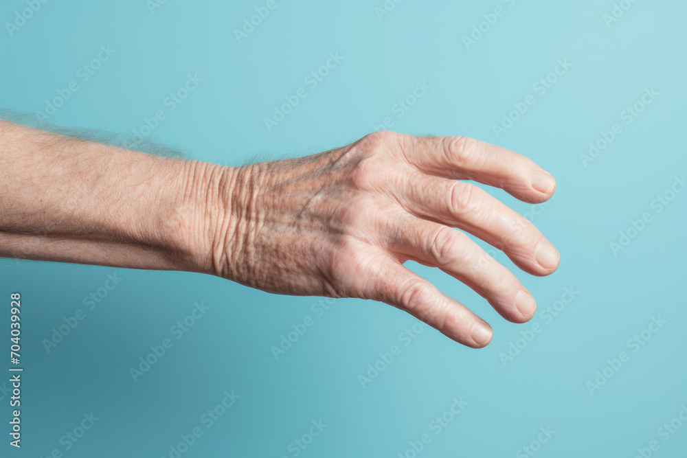 The palm of an elderly grandfather, showcasing a swollen vein and joint, illustrating common health problems in the elderly. The palm of an elderly grandfather, showcasing a swollen vein and joint, illustrating common health problems in the elderly.